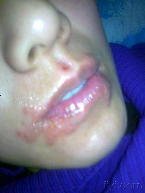 唇周图片,揭秘美丽唇形的秘密